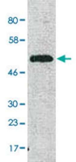 COX15 Rabbit anti-Human, Polyclonal, Abnova 100uL:Antibodies, Polyclonal