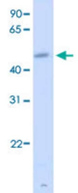 CREB3L2 Rabbit anti-Human, Polyclonal, Abnova 100uL:Antibodies, Polyclonal