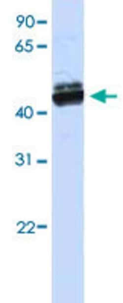 CREB3L2 Rabbit anti-Human, Polyclonal, Abnova 100uL:Antibodies, Polyclonal