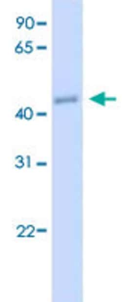 CREB3L2 Rabbit anti-Human, Polyclonal, Abnova 100uL:Antibodies, Polyclonal