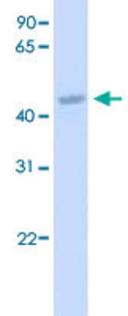 CREB3L2 Rabbit anti-Human, Polyclonal, Abnova 100uL:Antibodies, Polyclonal