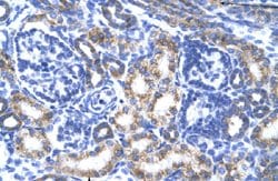 CREB3L2 Rabbit anti-Human, Polyclonal, Abnova 100uL:Antibodies, Polyclonal