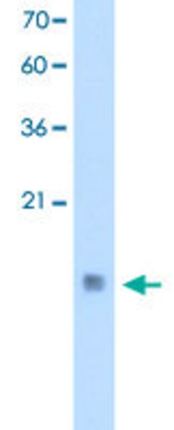 CSTB Rabbit anti-Human, Polyclonal, Abnova 100uL:Antibodies, Polyclonal