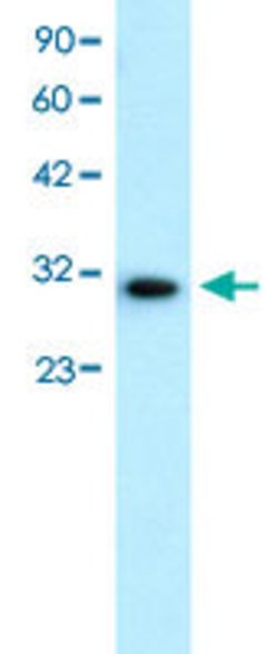 DBP Rabbit anti-Human, Polyclonal, Abnova 100uL:Antibodies, Polyclonal