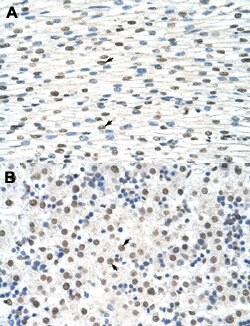 DDX19B Rabbit anti-Human, Polyclonal, Abnova 100uL:Antibodies, Polyclonal