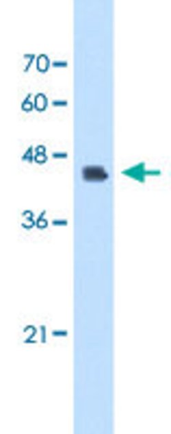 DFNA5 Rabbit anti-Human, Polyclonal, Abnova 100uL:Antibodies, Polyclonal