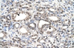 DFNA5 Rabbit anti-Human, Polyclonal, Abnova 100uL:Antibodies, Polyclonal