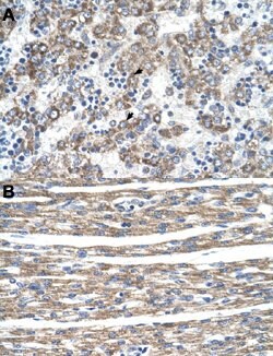 DLX5 Rabbit anti-Human, Polyclonal, Abnova 100 &mu;L | Buy Online | Abnova Corporation | Fisher Scientific