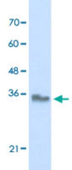 EXOSC3 Rabbit anti-Human, Polyclonal, Abnova 100uL:Antibodies