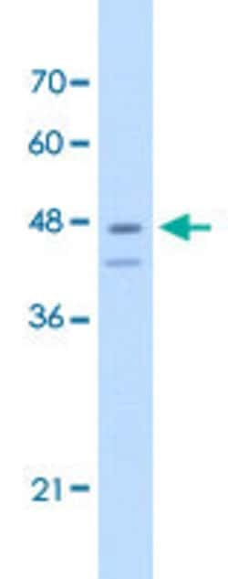 FAH Rabbit anti-Human, Polyclonal, Abnova 100uL:Antibodies, Polyclonal
