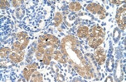 FAH Rabbit anti-Human, Polyclonal, Abnova 100uL:Antibodies, Polyclonal