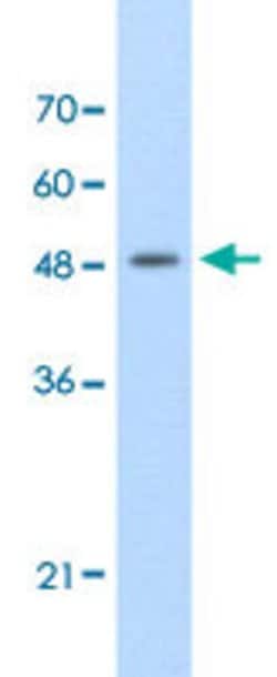 FAM174B Rabbit anti-Human, Polyclonal, Abnova 100uL:Antibodies, Polyclonal