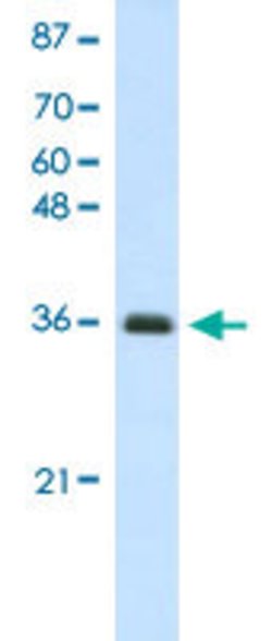 FBL Rabbit anti-Human, Polyclonal, Abnova 100uL:Antibodies, Polyclonal