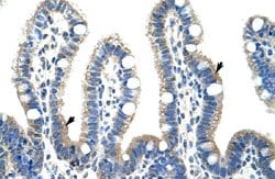 FBL Rabbit anti-Human, Polyclonal, Abnova 100uL:Antibodies, Polyclonal