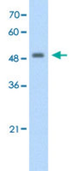 FBXL7 Rabbit anti-Human, Polyclonal, Abnova 100 &mu;L | Buy Online | Abnova Corporation | Fisher Scientific