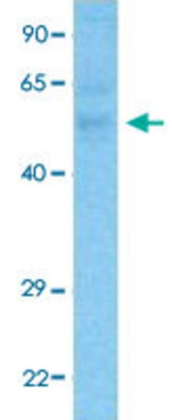 FBXL7 Rabbit anti-Human, Polyclonal, Abnova 100 &mu;L | Buy Online | Abnova Corporation | Fisher Scientific