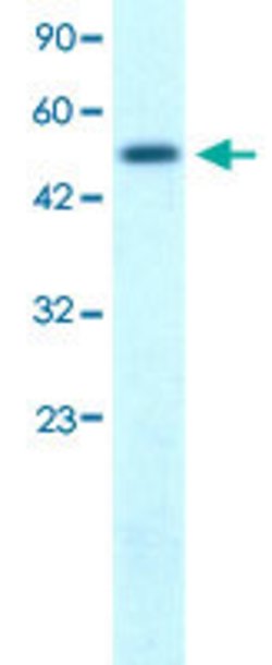 FIZ1 Rabbit anti-Human, Polyclonal, Abnova 100uL:Antibodies, Polyclonal
