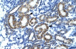 FIZ1 Rabbit anti-Human, Polyclonal, Abnova 100uL:Antibodies, Polyclonal