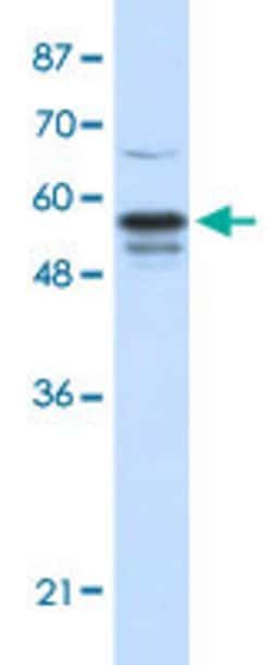 FOXG1 Rabbit anti-Human, Polyclonal, Abnova 100uL:Antibodies, Polyclonal