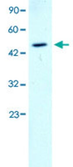 GATA2 Rabbit anti-Human, Mouse, Polyclonal, Abnova 100uL:Anticuerpos