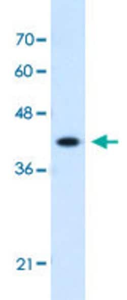 GOT2 Rabbit anti-Human, Polyclonal, Abnova 100uL:Antibodies, Polyclonal