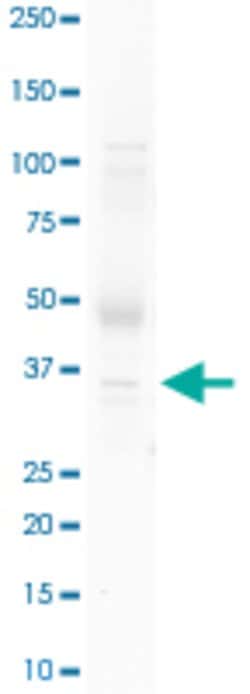 GSX2 Rabbit anti-Human, Polyclonal, Abnova 100uL:Anticuerpos