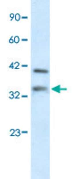 GSX2 Rabbit anti-Human, Polyclonal, Abnova 100uL:Anticuerpos