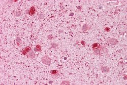 GSX2 Rabbit anti-Human, Polyclonal, Abnova 100uL:Anticuerpos