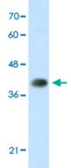 HNRNPA3 Rabbit anti-Human, Polyclonal, Abnova 100uL:Antibodies, Polyclonal