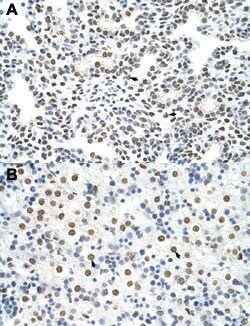 HNRNPA3 Rabbit anti-Human, Polyclonal, Abnova 100uL:Antibodies, Polyclonal