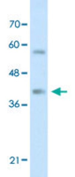 HNRNPA3 Rabbit anti-Human, Polyclonal, Abnova 100uL:Antibodies, Polyclonal