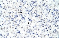 HNRNPL Rabbit anti-Human, Polyclonal, Abnova 100uL:Antibodies, Polyclonal