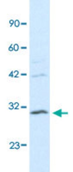 HOXB5 Rabbit anti-Human, Polyclonal, Abnova 100uL:Antibodies, Polyclonal