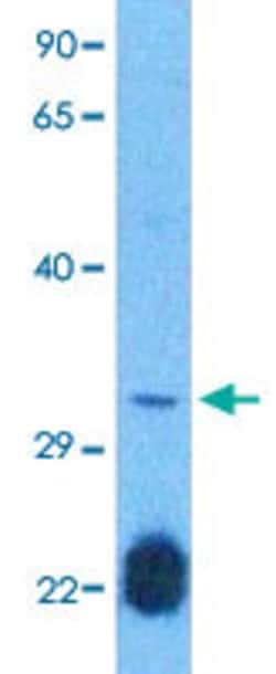 HOXB5 Rabbit anti-Human, Polyclonal, Abnova 100uL:Antibodies, Polyclonal