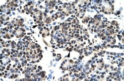 HOXB5 Rabbit anti-Human, Polyclonal, Abnova 100uL:Antibodies, Polyclonal