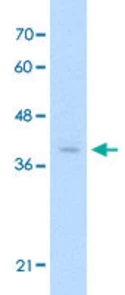 HSD17B1 Rabbit anti-Human, Polyclonal, Abnova 100uL:Antibodies, Polyclonal