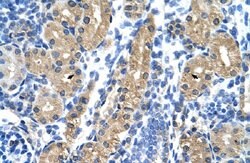 HSD17B1 Rabbit anti-Human, Polyclonal, Abnova 100uL:Antibodies, Polyclonal
