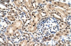 IFIT3 Rabbit anti-Human, Polyclonal, Abnova 100uL:Antibodies, Polyclonal