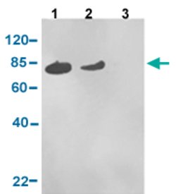 MAPT (phospho S409) Rabbit anti-Human, Polyclonal, Abnova 40ug:Antibodies,
