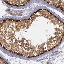 MAGEB1 Rabbit anti-Human, Polyclonal, Abnova 100uL:Antibodies, Polyclonal