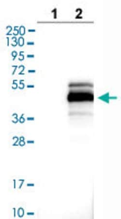 MAGEB1 Rabbit anti-Human, Polyclonal, Abnova 100uL:Antibodies, Polyclonal