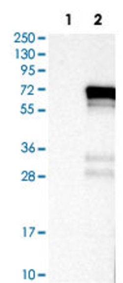 ESR1 Rabbit anti-Human, Polyclonal, Abnova 100 &mu;L | Buy Online | Abnova | Fisher Scientific