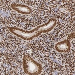 ESR1 Rabbit anti-Human, Polyclonal, Abnova 100 &mu;L | Buy Online | Abnova | Fisher Scientific