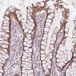 ATP1B3 Rabbit anti-Human, Polyclonal, Abnova 100uL:Antibodies, Polyclonal