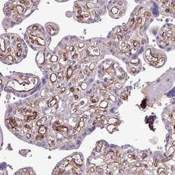 CD248 Rabbit anti-Human, Polyclonal, Abnova 100 &mu;L | Buy Online | Abnova Corporation | Fisher Scientific