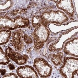 TNFSF10 Rabbit anti-Human, Polyclonal, Abnova 100uL:Antibodies, Polyclonal