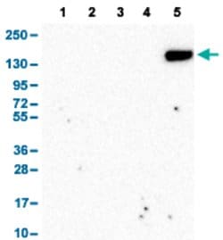 CR2 Rabbit anti-Human, Polyclonal, Abnova 100uL:Antibodies, Polyclonal