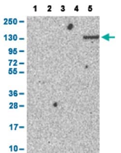 ENPP1 Rabbit anti-Human, Polyclonal, Abnova 100uL:Antibodies, Polyclonal