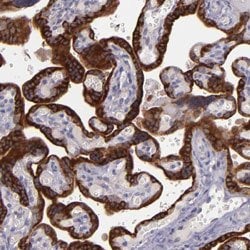 PAPPA Rabbit anti-Human, Polyclonal, Abnova 100uL:Antibodies, Polyclonal