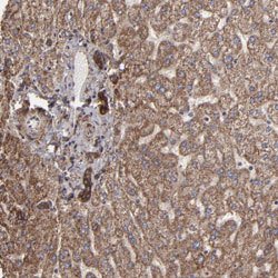 ITGB5 Rabbit anti-Human, Polyclonal, Abnova 100uL:Antibodies, Polyclonal